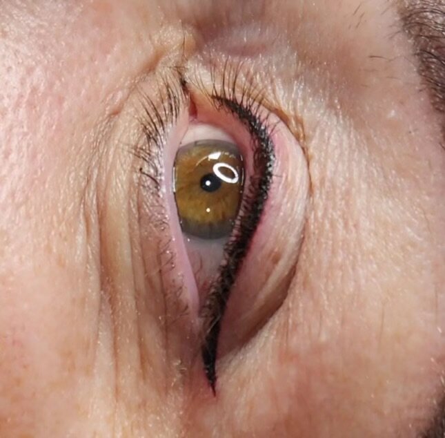 Permanent eyeliner along the upper lash line