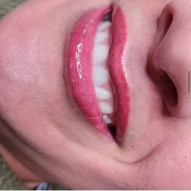 Lip blushing result in a bright rose tone
